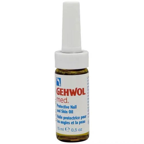 小儿荨麻疹是什么症状 小儿荨麻疹是什么症状