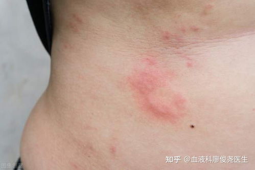 芙兰朵露脚气 芙兰朵露对人类的好感度 芙兰朵露脚气 芙兰朵露对人类的好感度