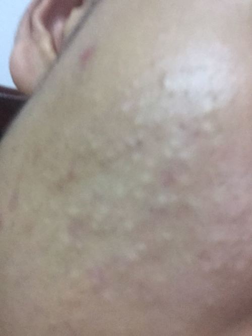 ˮ���ͽ����ر�� ˮ���ͽ���Խ��Խ������ô��