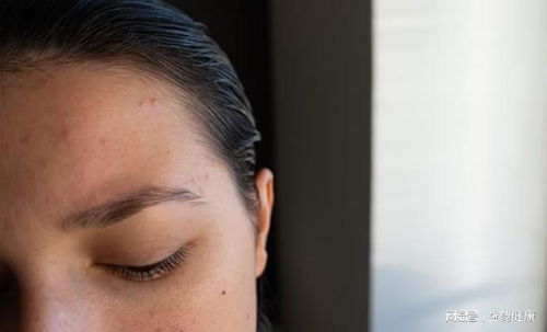 哪些原因会导致灰指甲 哪些原因会导致灰指甲