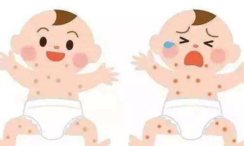 腰间盘突出疼的厉害怎么办 腰间盘突出疼的厉害怎么办