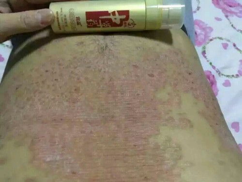 �ý�����ʲô �ý�����ʲôҩˮ��