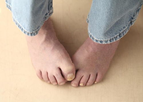 上海哪家医院能看肛周湿疹 上海哪家医院能看肛周湿疹