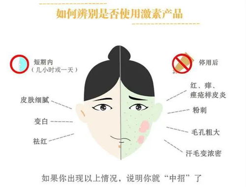 猩红热与慢性荨麻疹的关系 猩红热与慢性荨麻疹的关系