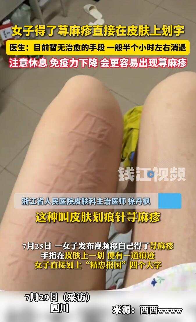 北京人脚气 北方人脚气多还是南方人脚气多 北京人脚气 北方人脚气多还是南方人脚气多