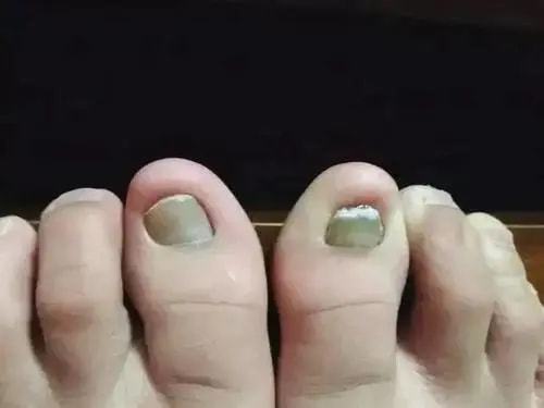 ˮ�ݽ�������������