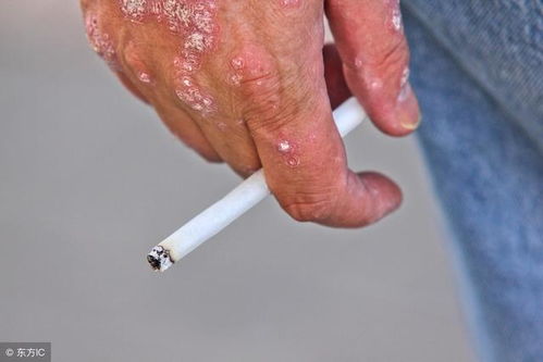 景德镇一医院美容外科价目表公开 去痤疮案例分享 光疗效果一览 景德镇一医院美容外科价目表公开 去痤疮案例分享 光疗效果一览