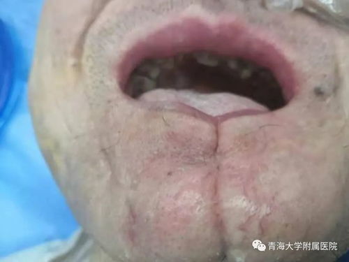 生活小妙招白醋治脚气吗 生活小妙招白醋治脚气吗