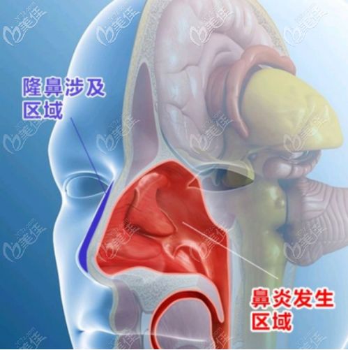 �����ν����� ����������