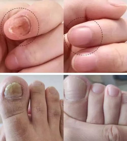 �������ؽ��� �������ؽ�����ô����