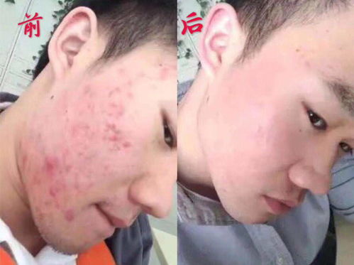 小偏方治好脚气 小偏方治好脚气