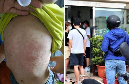 脑梗的前兆有哪些反应 脑梗的前兆有哪些反应