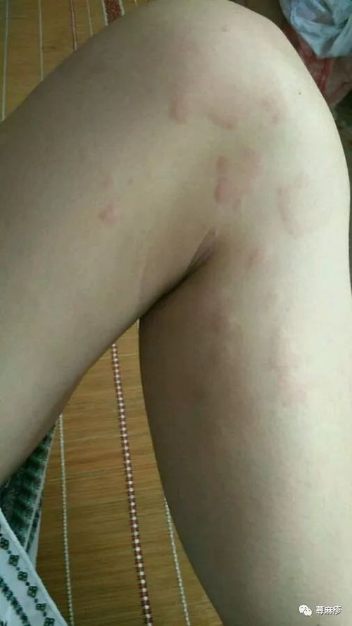 ��ͷ��Ƥ����ô���