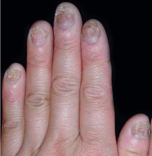 Щԭᵼõγ õʱּ 