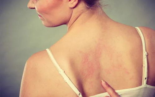 ���綼����Щ֢״