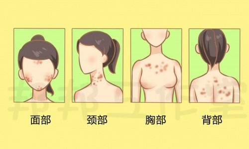 头油里有艾滋病毒吗 头油里有艾滋病毒吗