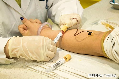 灰指甲患者应该怎么做好护理 灰指甲患者应该怎么做好护理