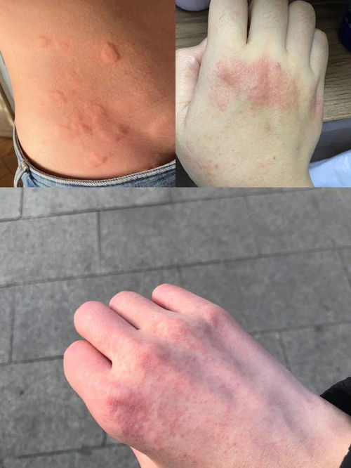 �и�Ϊʲô�����ʪ��