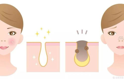 ���¾��°ͳ��۴���ʲôԭ��