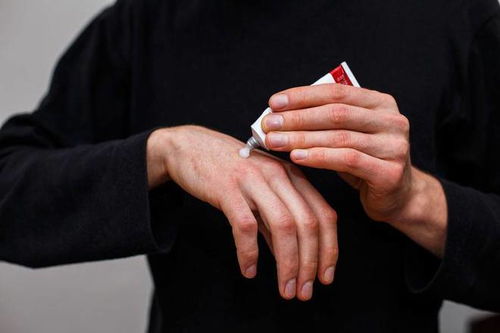 灰指甲真菌怎么杀死 灰指甲真菌怎么杀死