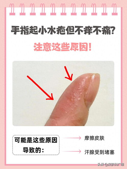 灰指甲复发的原因有什么 灰指甲复发的原因有什么