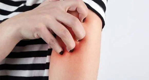 子宫平滑肌瘤是良性肿瘤吗 子宫平滑肌瘤是良性肿瘤吗