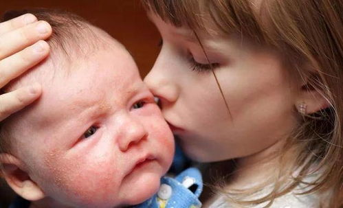 颈部长闭合痤疮的原因是什么 颈部长闭合痤疮的原因是什么