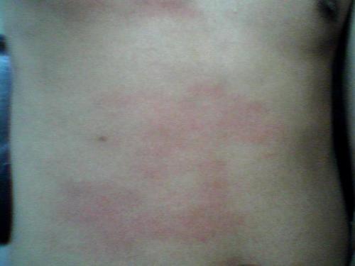 ���̲���Ⱦ�м�������