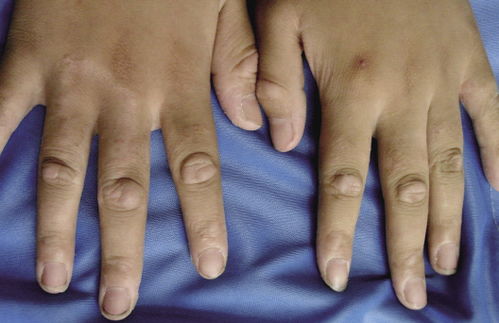 ��������Ѣ��ʲôҩ���