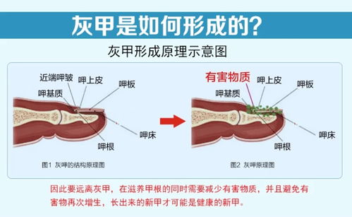 脚气影响备孕吗 脚气影响备孕吗