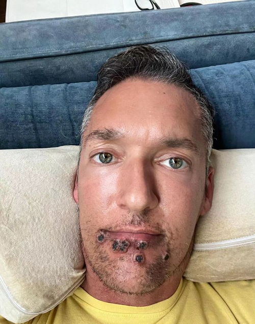 �̺���ôȥ��