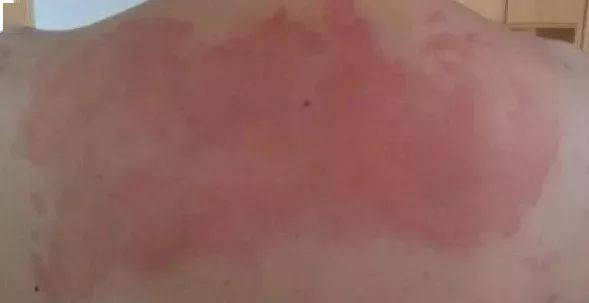 ǭרҽԺ һֱôź