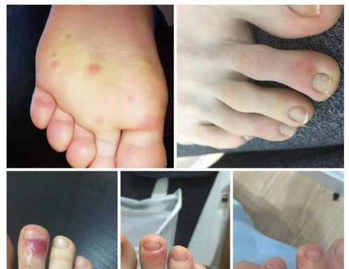 ���ϳ�����ʲôԭ��