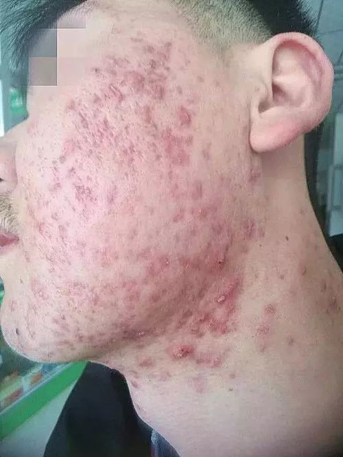 ˢ������ǻ�а�ɫճĤ