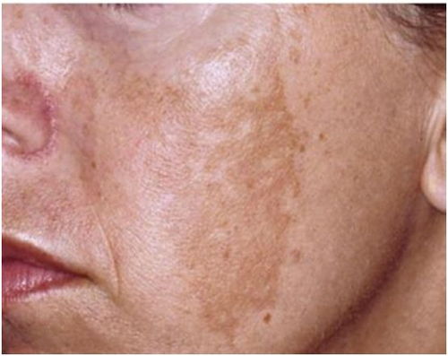 ��Ĵָָ�װ�����ʲôԭ��