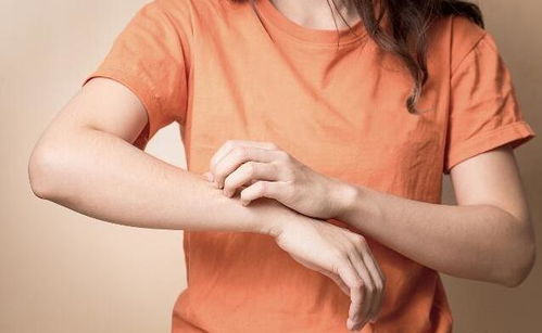 治疗婴儿湿疹的一些方法 治疗婴儿湿疹的一些方法