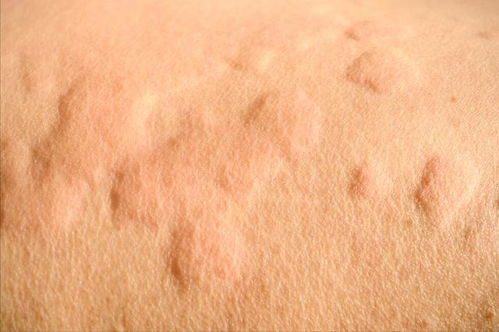 身上一阵冷一阵热是怎么回事 身上一阵冷一阵热是怎么回事