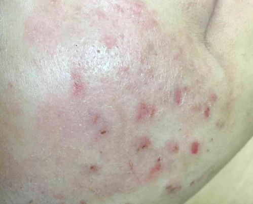 ������ţƤѢ�ļҺ� ţƤѢ����ô�����