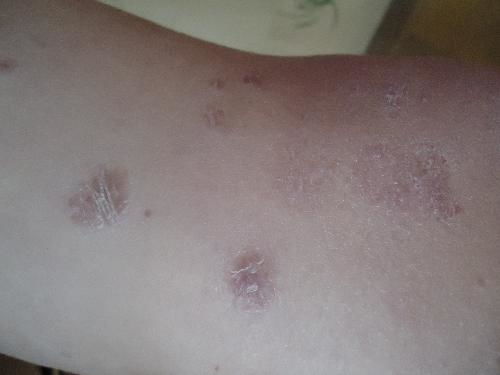 ����ţƤѢ��������ҩ��ȽϺ�