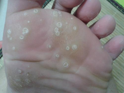 �����׶���ţƤѢ���ļҺ�