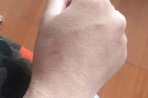 ��������ţƤѢ���ĸ���