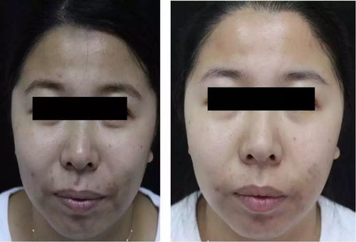 ������ţƤѢ�ļҺ� ţƤѢ������ʳ����