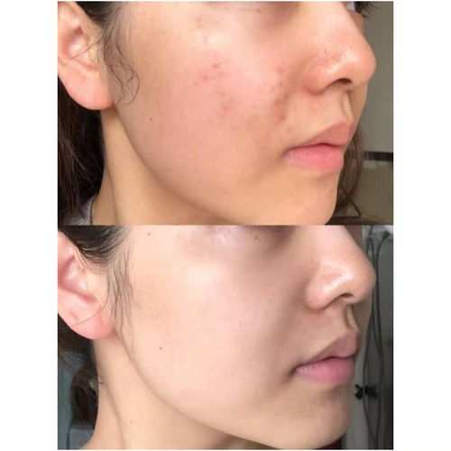 ţƤѢԽ������Խ�� ����ţƤѢ�����Ⱦ