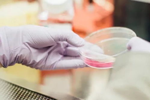 宝宝两个月了还有黄疸怎么办 宝宝两个月了还有黄疸怎么办