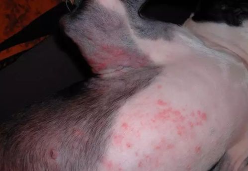 湿疹的克星是什么药 湿疹的克星是什么药