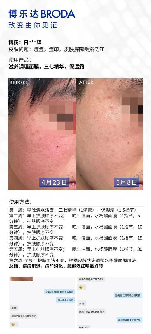 褐色胎记有什么危害吗 褐色胎记有什么危害吗