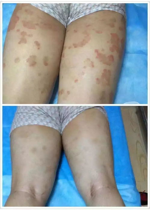 ţƤƤѢ���ƽ�չ������������ ʯ��ׯרҵţƤѢ����