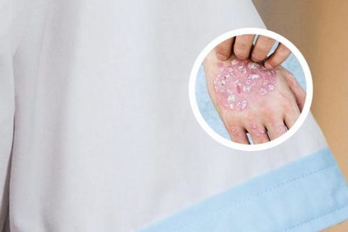 ţƤѢ������ʱ��Ҫ��Щ