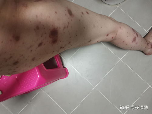 我国成为全球第10个国际认证救援体系国家 我国成为全球第10个国际认证救援体系国家