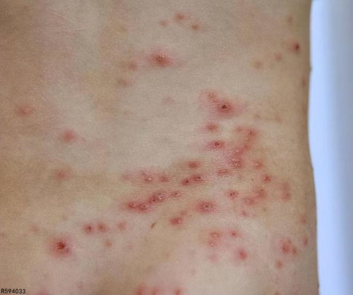 ��ΰ���ţƤѢ